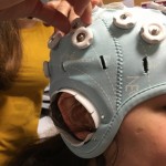 EEG setup for test